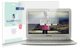 Samsung Chromebook 11.6" (XE303C12) Laptop Screen Protector