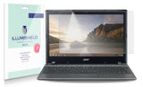 Acer Chromebook 11.6" (C710) Laptop Screen Protector