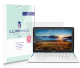 HP Chromebook 11 Laptop Screen Protector