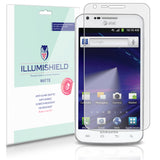 Samsung Galaxy S2 Skyrocket (S II Skyrocket,I727) Cell Phone Screen Protector