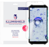 Ulefone X9 Pro [3-Pack] iLLumiShield Clear Screen Protector